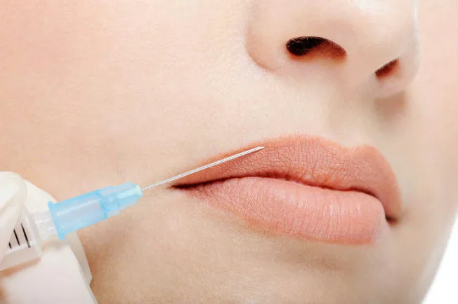 Descubre el Aumento de Labios en Alicante: Belleza Natural al Alcance de Tu Mano